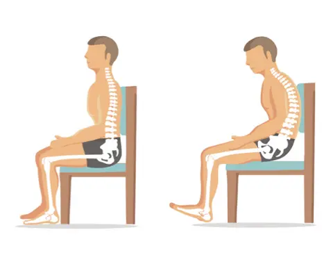 Posture Therapy in San Jose, CA